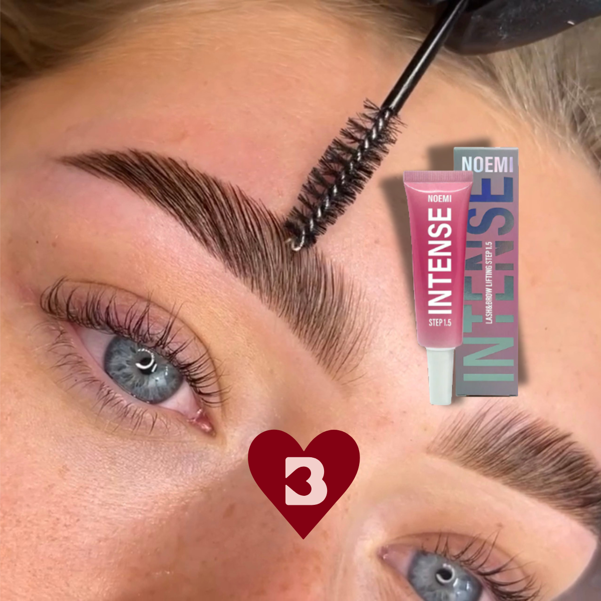 Brow lift qui ne tient pas : les vraies causes